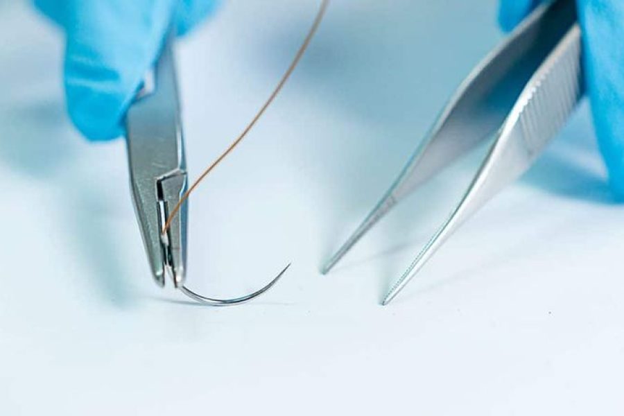 ¿Conoces los tipos de suturas y su clasificación_ - Noticias en Salud